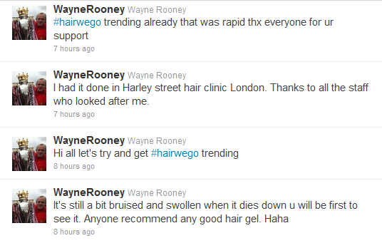 Wayne Rooney tweets about his hair transplant